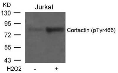 Western Blot: Cortactin [p Tyr466] Antibody [NB100-81871]